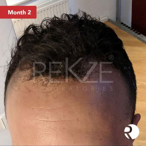  REKZE 24 Clinically Proven Hair Growth Serum & Anti-Hair Loss Treatment For Men & Women, For Thinning Hair, Thickening & Regrowth, Strong DHT Blocker With Procapil, Keratin, Collag