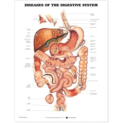 ACC Diseases of The Digestive System Anatomical Chart