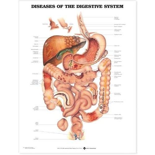  ACC Diseases of The Digestive System Anatomical Chart