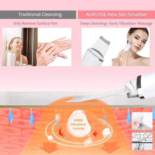  [아마존 핫딜] [아마존핫딜]AUKUYEE Ultraschall Haut Scrubber, Haut Scrubber Ultraschall-Peeling Porenreiniger Skin Scrubber Akne-Entferner Ionen Hautreiniger fuer Gesichtsreinigung Gesichtspflege (Weiss)