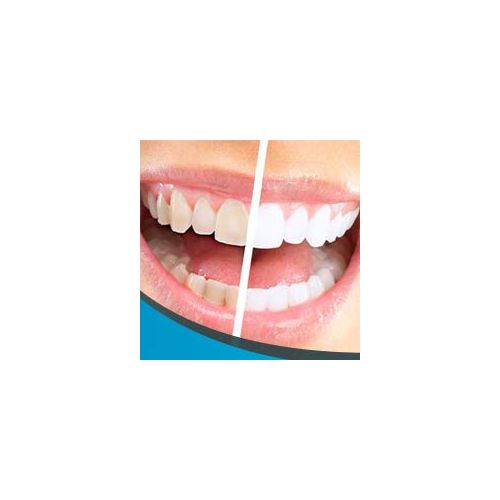  Active Sparkle  Top Quality, Expedient Teeth Whitening Charcoal Powder