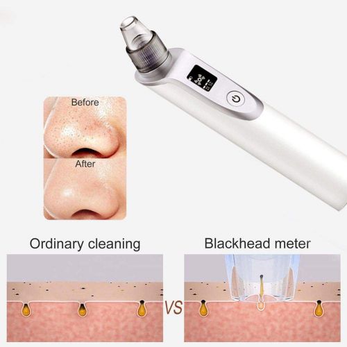  Alian Nasal Aspirator for Newborn Baby,Nose Cleaner, Adult Blackhead Remover,Beauty Instrument