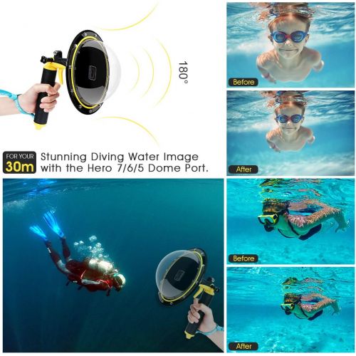  [아마존베스트]AuyKoo Waterproof Eye with Domo Connector Housing for GoPro Hero 2018/7/6/5 Lens Cap for Bubbles, GoPro Accessories with Trigger Gun and Floating Handles, Underwater Photography