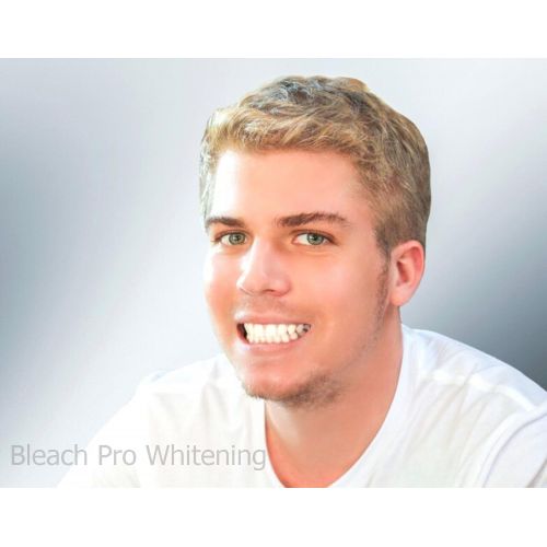  Bleach Pro Whitening 100 Teeth Whitening Gel 35% Carbamide Peroxide 3ml Syringes