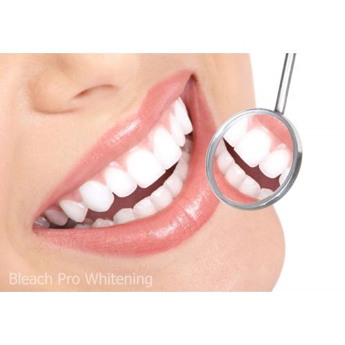  Bleach Pro Whitening 100 Teeth Whitening Gel 35% Carbamide Peroxide 3ml Syringes