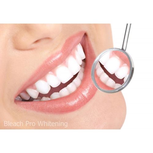  Bleach Pro Whitening 25 Teeth Whitening Gel 22% Carbamide Peroxide 10ml Syringes