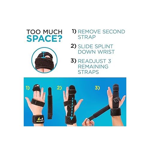  BraceAbility Two Finger Immobilizer - Hand and Buddy Splint Cast for Broken Joints, Mallet or Trigger Finger Extension, Sprains and Contractures to Straighten Middle, Index and Pinky Knuckles (S)