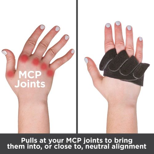  BraceAbility Ulnar Deviation & Drift Hand Splint | MCP Knuckle Joint Support Brace for Rheumatoid Arthritis & Tendonitis Pain Relief, Finger Straightener & Stretcher Glove - S (SM/