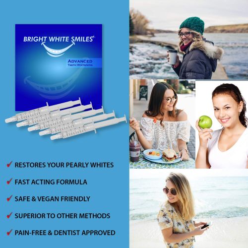  BrightWhiteSmiles Bright White Smiles Teeth Whitening Kit, 35% Carbamide Peroxide Gel for Professional Results at...