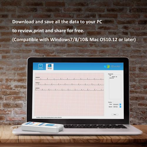  CaseSack EMAY Portable EKG (for Mac and Windows) to Record EKG & Heart Rate