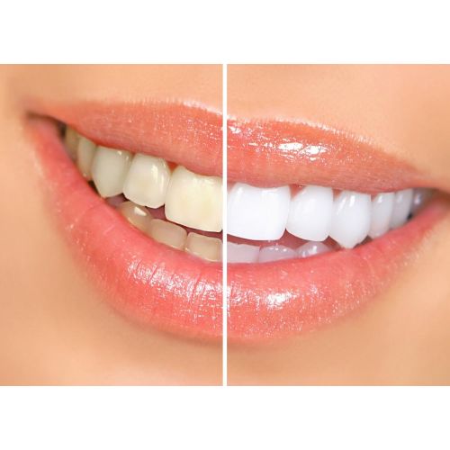  Dr. Smiles Pop & Prime Teeth Whitening Pens (3 Pack)