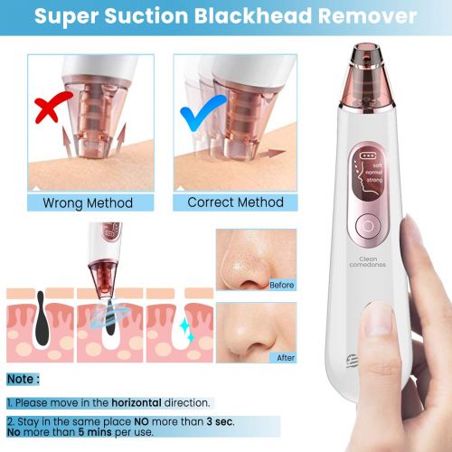  [아마존 핫딜]  [아마존핫딜]EIVOTOR Elektrisch Gesichts Mitesser Entferner 4 in 1 Vakuum Sauger Mitesserentferner 3 Modi Mitesser Sauger Porenreiniger Blackhead Remover Nase Poren Akne Entferner Gerat mit Pic