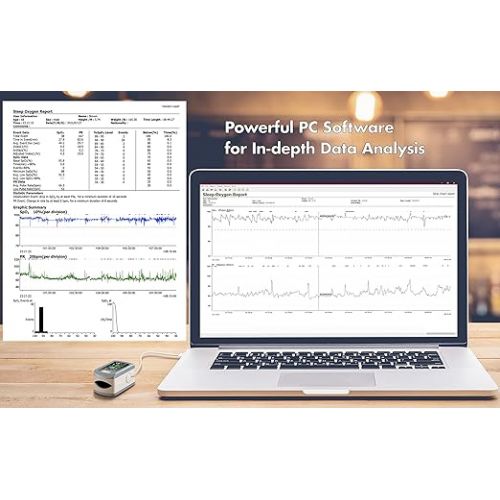  EMAY Sleep Oxygen Monitor with PC Software & App | Bluetooth Pulse Oximeter Rechargeable for Overnight & Continuous SpO2 Tracking with 72 Hours Built-in Memory | Gives Informative Report & Analysis