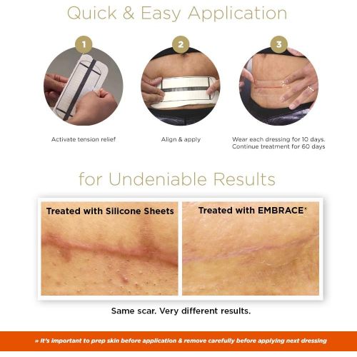  Embrace Scar Treatment, Silicone Sheets for New Scars with Active Scar Defense, Small 1.6 Inch Sheets, 6 Count, Recommended Full Treatment (60 Day Supply)