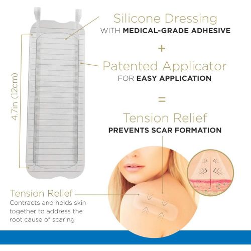  Embrace Scar Treatment, Silicone Sheets for New Scars with Active Scar Defense, Small 1.6 Inch Sheets, 6 Count, Recommended Full Treatment (60 Day Supply)