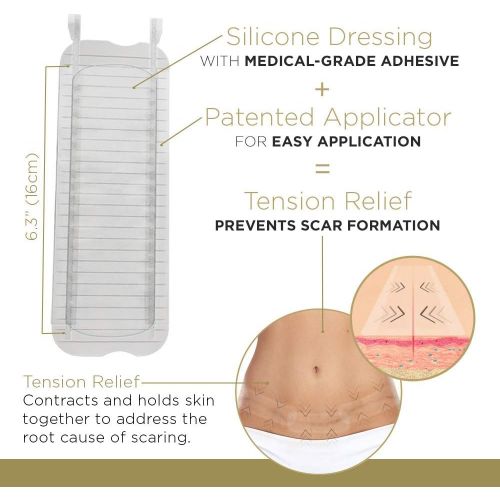  Embrace Scar Treatment, Silicone Sheets for New Scars with Active Scar Defense, Medium 2.4 Inch Sheets, 6 Count, Recommended Full Treatment (60 Day Supply)
