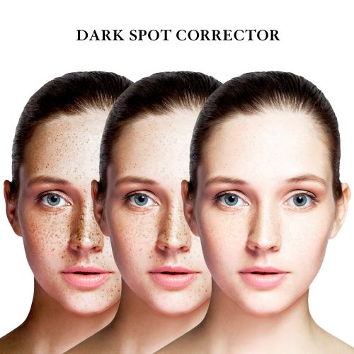  [아마존핫딜][아마존 핫딜] EnaSkin Dark Spot Corrector Remover for Face and Body,Formulated with Advanced Ingredient 4-Butylresorcinol, Kojic Acid, Lactic Acid and Salicylic Acid