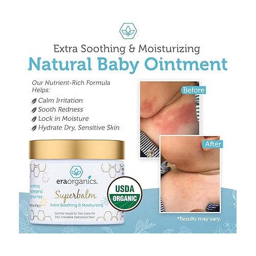  Era Organics Healing Ointment for Babies - USDA Certified Organic Natural Gentle Moisturizer for Sensitive Skin Prone To Baby Eczema, Cradle Cap (Infant Seborrheic Dermatitis), Rashes, Hives & More