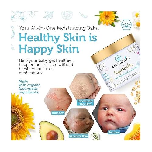  Era Organics Healing Ointment for Babies - USDA Certified Organic Natural Gentle Moisturizer for Sensitive Skin Prone To Baby Eczema, Cradle Cap (Infant Seborrheic Dermatitis), Rashes, Hives & More