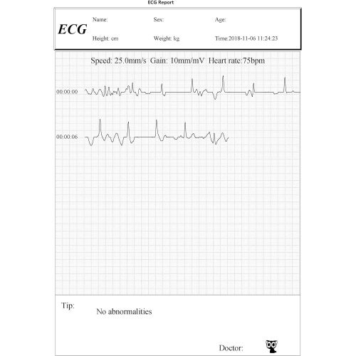  Facelake FL10 Portable ECGEKG Monitor with Bluetooth for for iOS and Android