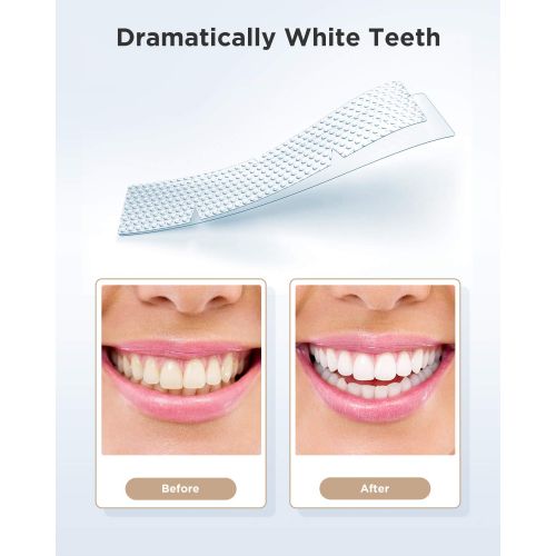  [아마존 핫딜]  [아마존핫딜]Fairywill Professional Teeth Whitening Strips with Non-Slip Tech, Safe for Enamel, 3D Strips pack of 28...