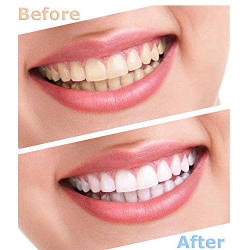  Fencia Teeth Whitening Accelerator Dental LED Whitening Lamp Teeth Bleaching Machine 110V -Blue/Purple/Red Light