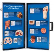 HEALTH EDCO W43081D Consequences of Diabetes 3D Display, 28 Length x 27 Height Opened