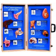 HEALTH EDCO W43057 The Consequences of Obesity 3D Display, 27 Length x 28 Height Opened