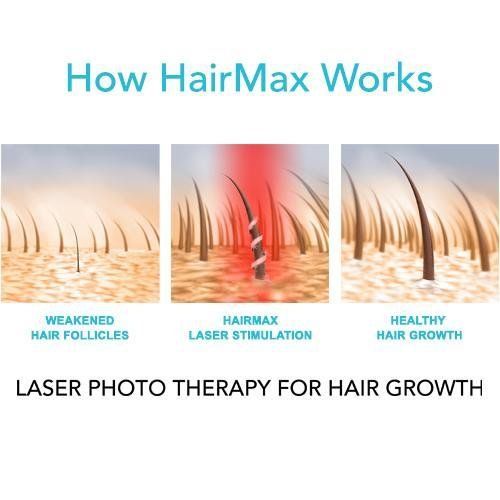  HairMax Ultima 12 LaserComb Hair Growth Device. Stimulates Hair Growth, Reverses Thinning, Regrows Denser, Fuller Hair. Targeted hair loss treatment. Light, Portable, FDA Cleared