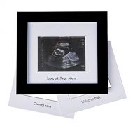 [아마존베스트]Iheipye Baby Sonogram Photo Frame - 1st Ultrasound Picture Frame - Idea Gift for Expecting Parents,Baby Shower,...