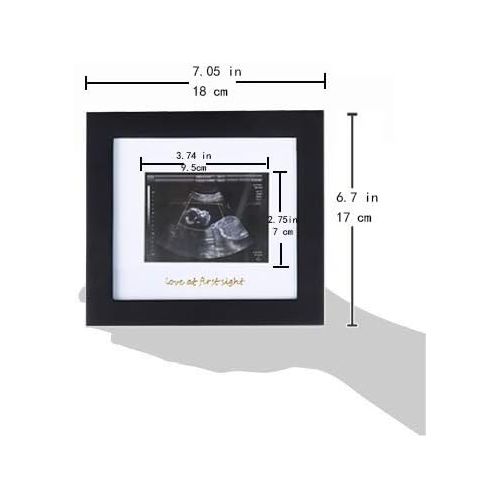  IHEIPYE Baby Sonogram Photo Frame - 1st Ultrasound Picture Frame - Idea Gift for Expecting Parents,Baby Shower, Gender Reveal Party,Baby Nursery Decor (Gold Text, Black)