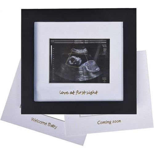  IHEIPYE Baby Sonogram Photo Frame - 1st Ultrasound Picture Frame - Idea Gift for Expecting Parents,Baby Shower, Gender Reveal Party,Baby Nursery Decor (Gold Text, Black)