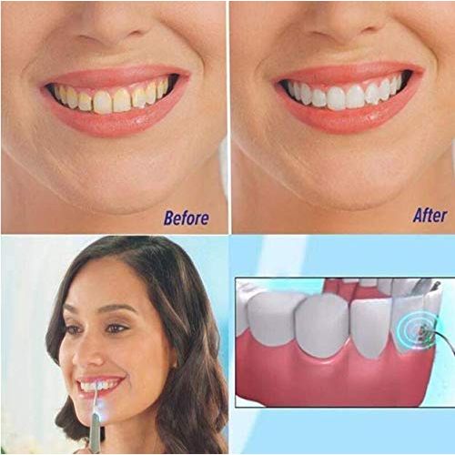  LIJIANGUO 1PC Professional Dental Cleaning Tools Electric Sonic Pic Tooth Stain Eraser Plaque Remover Portable...