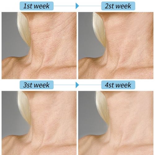  [아마존 핫딜]  [아마존핫딜]LuckyFine Cream y.f.m Intensive Moisturising Cream Anti Wrinkle/Ageing Smooth Skin Whitening Moisturizing Treatment Skincare For A Faltenfreieren Firmer Neck and Skin, 50g
