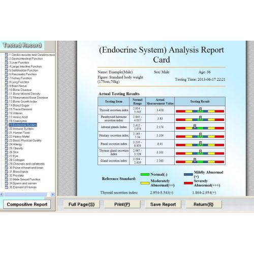 메디콤 Computer Aided Chequeo Medicomat-29 * Quantum Resonancia Analizador Sistema de alta Tecnologa Linear Informatizado no Health Care Instrumento