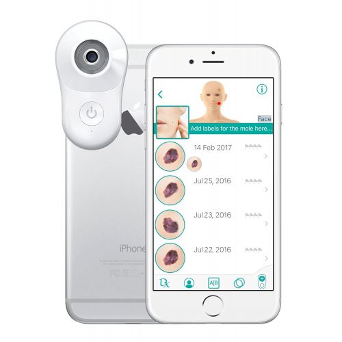  MoleScope II (Professionals) - Smartphone Attachable Dermoscope for iPhone 7+