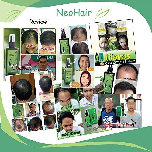  Neo Hair Lotion