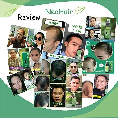  Neo Hair Lotion