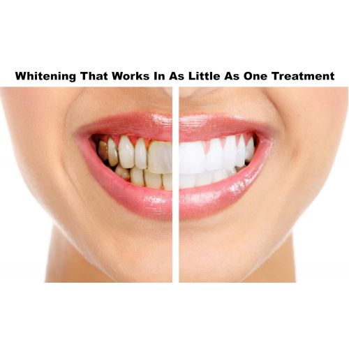  Organic Labs Activated Charcoal Teeth Whitening Advanced Home Treatment Kit Faster Results For Whiter Teeth