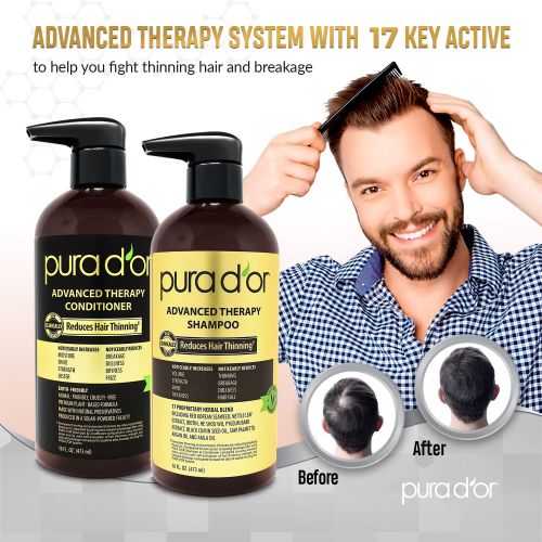  [아마존 핫딜] [아마존핫딜]PURA D’OR Advanced Therapy System - Biotin Shampoo & Conditioner Increases Volume, Strength & Shine, Sulfate Free, Made with Argan Oil, All Hair Types, Men & Women, 16 fl oz (Packa