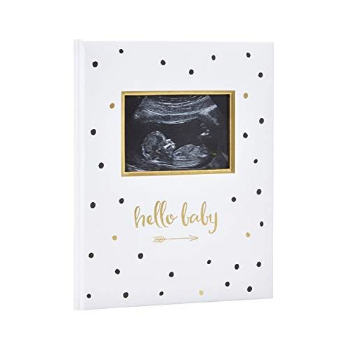  [아마존베스트]Pearhead First 5 Years Baby Memory Book with Sonogram Photo Insert, Black and Gold Polka Dot