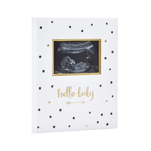  [아마존베스트]Pearhead First 5 Years Baby Memory Book with Sonogram Photo Insert, Black and Gold Polka Dot