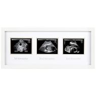 [아마존베스트]Pearhead Triple Sonogram Pregnancy Keepsake Frame, Watch Baby Grow Through All Three Trimesters - Great Gift for Expecting Parents, Baby Shower Gift, White