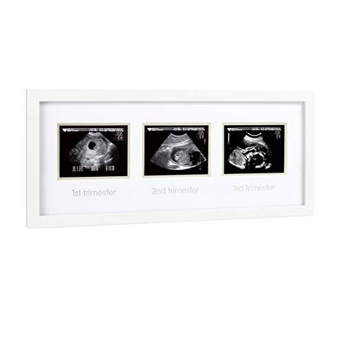 [아마존베스트]Pearhead Triple Sonogram Pregnancy Keepsake Frame, Watch Baby Grow Through All Three Trimesters - Great Gift for Expecting Parents, Baby Shower Gift, White