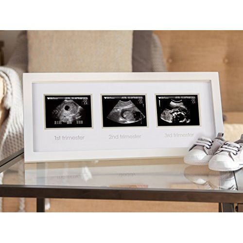  [아마존베스트]Pearhead Triple Sonogram Pregnancy Keepsake Frame, Watch Baby Grow Through All Three Trimesters - Great Gift for Expecting Parents, Baby Shower Gift, White