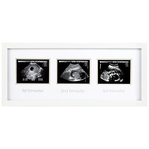  [아마존베스트]Pearhead Triple Sonogram Pregnancy Keepsake Frame, Watch Baby Grow Through All Three Trimesters - Great Gift for Expecting Parents, Baby Shower Gift, White