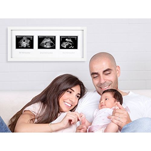  [아마존베스트]Pearhead Triple Sonogram Pregnancy Keepsake Frame, Watch Baby Grow Through All Three Trimesters - Great Gift for Expecting Parents, Baby Shower Gift, White