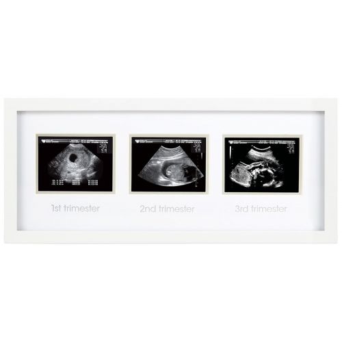  [아마존베스트]Pearhead Triple Sonogram Pregnancy Keepsake Frame, Watch Baby Grow Through All Three Trimesters - Great Gift for Expecting Parents, Baby Shower Gift, White