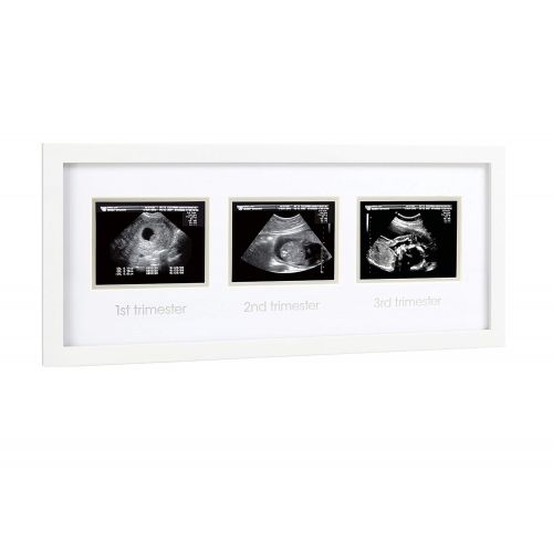  [아마존베스트]Pearhead Triple Sonogram Pregnancy Keepsake Frame, Watch Baby Grow Through All Three Trimesters - Great Gift for Expecting Parents, Baby Shower Gift, White