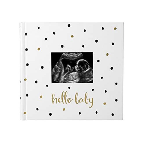  [아마존베스트]Pearhead Hello Baby Baby Photo Album, White/Black and Gold Polka Dot